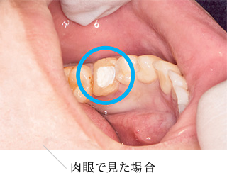 肉眼で見た場合