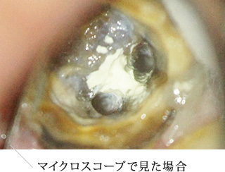 マイクロスコープで見た場合