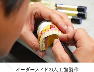 オーダーメイドの人工歯制作