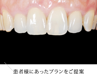 患者様に合ったプランをご提案
