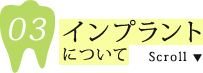 インプラントについて