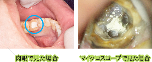 肉眼で見た場合・マイクロスコープで見た場合