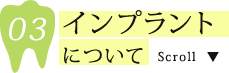 インプラントについて
