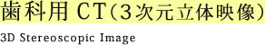歯科用CT(3次元立体映像)